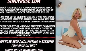 Sindy Rose self anal fisting &_ extreme prolapse on bed